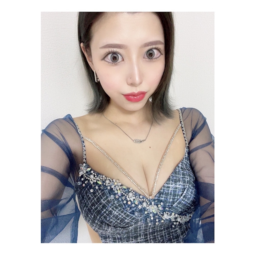 ｼﾞｬｶﾞ(🥔⍨  )(  ⍨🐓)ﾘｺｰ