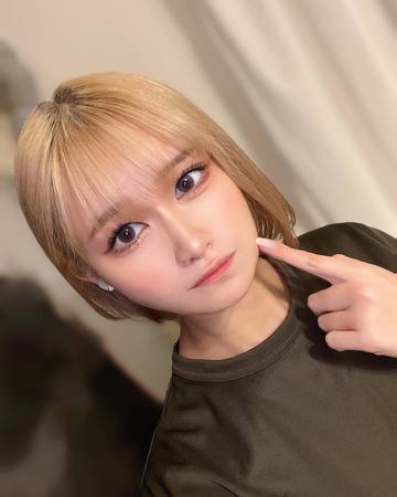 親知らず抜歯顔面ぷくぷく･･･